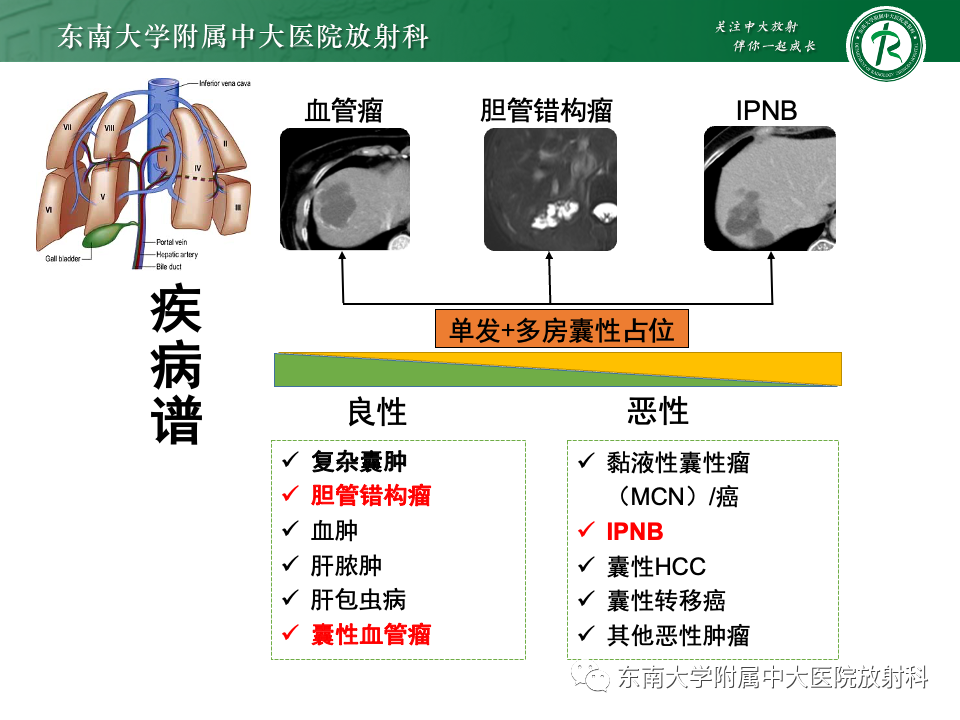 多囊肝最新研究与治疗进展